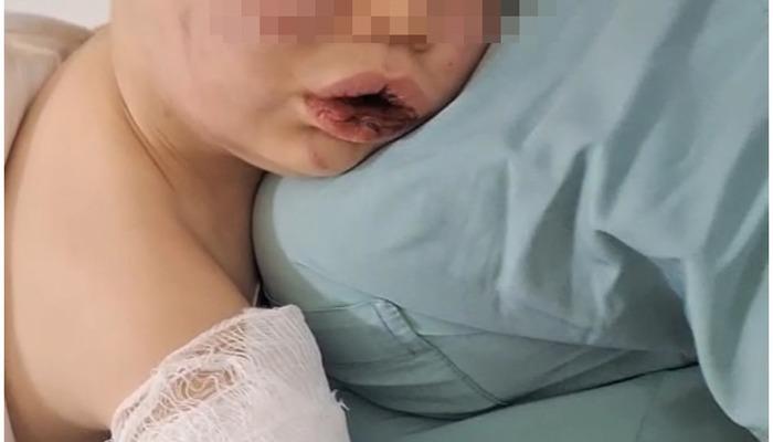Saldırganlıktan sonra hastaneye kaldırılan çocuk devletin korunması altında alınacak